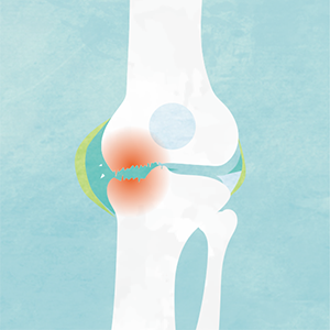 膝関節について 根本昌幸の人工膝関節置換術専門サイト